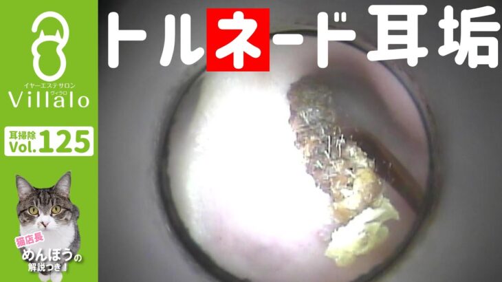 耳掃除 vol.125「トルネード耳垢」(ear wax removal)イヤーエステサロンVillalo～ヴィラロ～